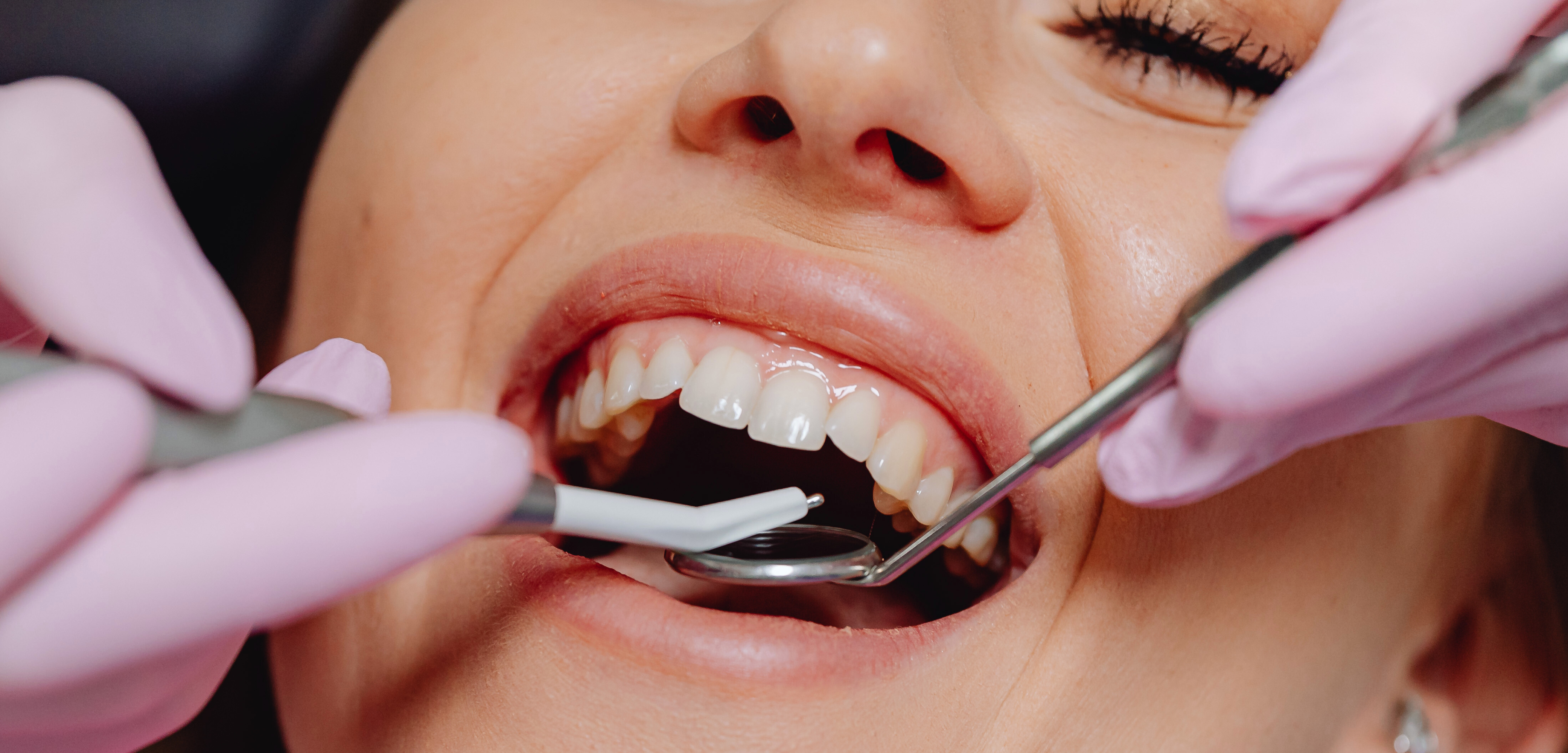 Com que Frequência Devo Ir ao Dentista? Entenda a Importância das Consultas Regulares